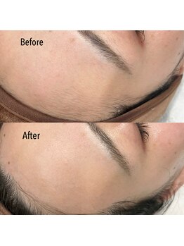 ジプシー(GYPSY.)/【フェイシャルワックス脱毛】