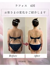 エンク(ENQU)/ビフォーアフター