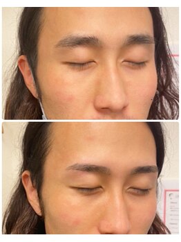 アイビー 人形町店(i.b)/眉【before⇒after】１５２