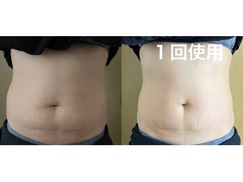 マイティー整骨院 ココア(CoCoa)/痩身マシン