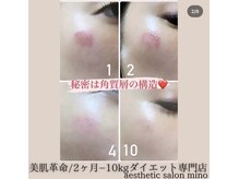 ミノ 美里大通り店(mino)/跡を残さない！