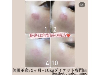 ミノ 美里大通り店(mino)/跡を残さない！