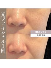 シーズボーテ(C's Beaute)/毛穴だるみケアにも効果的◎