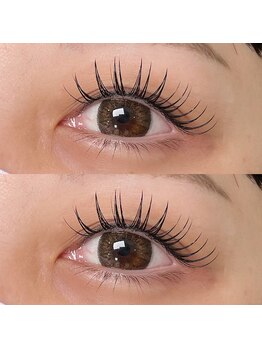 アイラ 本店(EYELA)/リフエク120本