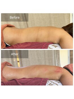 メゾンドメリッサ(MAISON de MELISSA)/