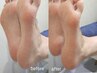 【フットケア】足裏角質ケアor自爪ケア《集中補修ケア/美容液保湿付き》¥4980