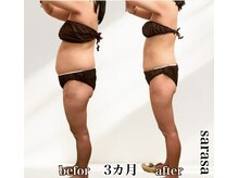 ナチュラル ビューティー スタイル さらさ(Natural Beauty Style)/さらさ痩身プログラム4カ月後