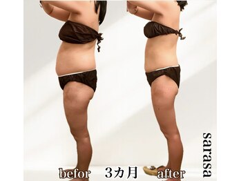 ナチュラル ビューティー スタイル さらさ(Natural Beauty Style)/さらさ痩身プログラム4カ月後