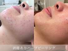 アパラギ(Aparagi)