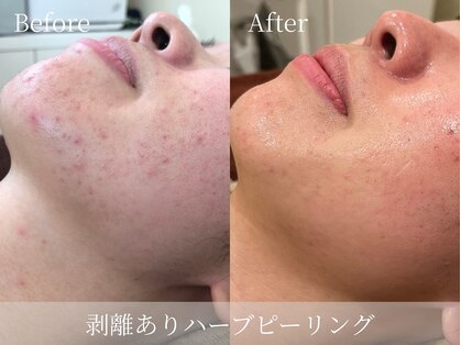 アパラギ(Aparagi)の写真