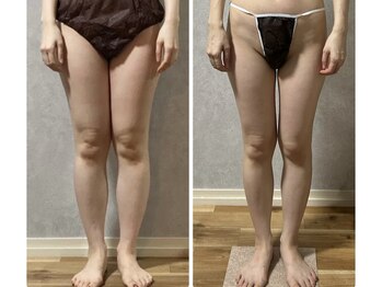 スリーピングビューティー(Sleeping Beauty)/