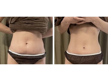 リムアール(Limh R)/