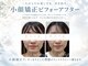 美人ヶ丘の写真