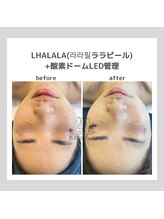 ポムハヌル(pom.haneul)/韓国肌管理室