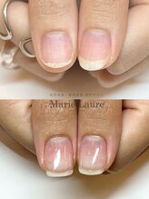 マリーロール 梅田店(Marie Laure)/自爪育成/深爪矯正/ネイルケア