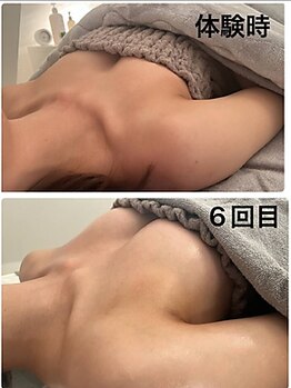 美人バスト 千葉店/バストケア