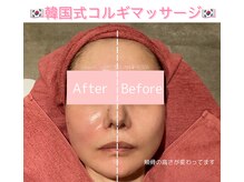 ビューティサロンテランセラ(beauty salon TELANTHERA)の雰囲気（お顔の歪み・小顔ケア★コルギマッサージのビフォーアフター★）