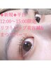 《平日12時～15時限定》〈新規〉まつげパーマ+リフトアップ美容鍼