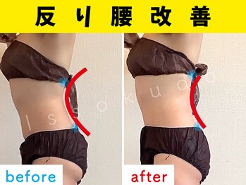 一息堂/20代女性「産後の骨盤矯正」