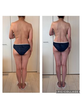 ハートエルボー(Heart elbow)/リバウンドレス