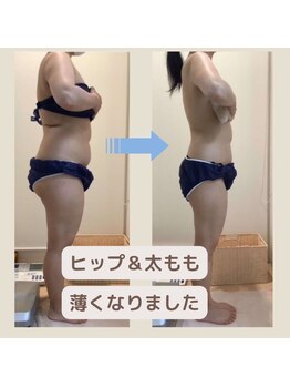 カブール 町田店/太もも-7センチ