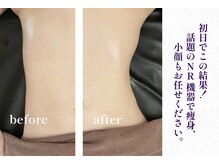 華月(KAGETSU)の雰囲気（のんびり効果を待つ時代はもうおしまい！初回で効果を実感♪）