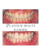 プラチナムビューティー 名古屋栄本店(PLATINUM BEAUTY)/お客様Before After 