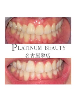 プラチナムビューティー 名古屋栄本店(PLATINUM BEAUTY)/お客様Before After