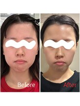 モアビューティー 紙屋町店/パックだけで？！