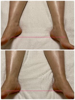 アールアンドアール(R&R)の写真/冷えむくみ改善は◎インディバで憧れの美脚つくりをサポート！血流巡る軽やかさ♪