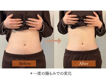 ハームス 桂店(HAARMS)/＊一度の腸もみでの変化