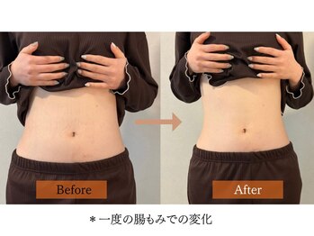 ハームス 桂店(HAARMS)/＊一度の腸もみでの変化