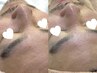 メンズフェイシャル◆つや肌毛穴集中ケア！毎週のお手入れに通いやすい¥3,300