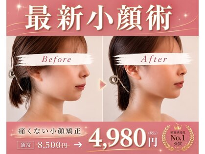 ルミライズヴィブリス(lumirise vibliss)の写真