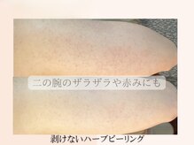 ノイエ(NOIE)の雰囲気(長年悩んだ肌悩みハーブピーリングで肌質改善!お顔もボディも◎)