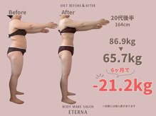 エテルナ(Eterna)
