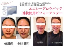 セラピエージ/エニシーグローパックで肌活！