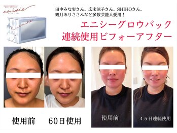 セラピエージ/エニシーグローパックで肌活！