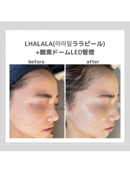 ポムハヌル(pom.haneul)/韓国肌管理室