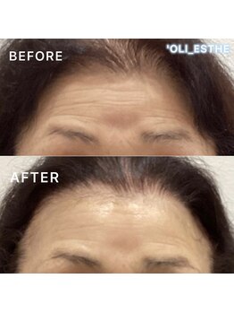 オリ('OLI)/プラズマニア