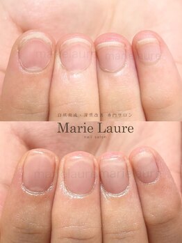 マリーロール 淀屋橋本店(Marie Laure)/自爪育成/深爪矯正/ネイルケア