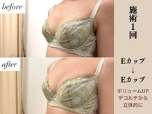 ソワ(soie)/年齢関係なく産後も美人バストに