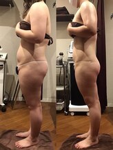 エスプレッソ(espresso,)/【全身20回】体の厚みも撃退！