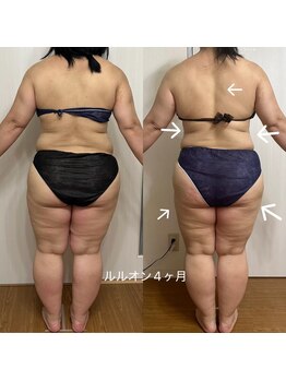 ヨサパーク ベル(YOSA PARK Belle)/ルルオン×水素吸入 回数券4ヶ月