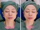 アコベル(Ako-Bell)の写真/【溝の口駅・高津駅】当店自慢のFace Slimmingで小顔とたるみケア◎実年齢よりも若々しいお顔立ちへ♪