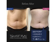 サロンドベル(salon de Belle)/クビレ