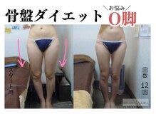 ユズ(yuzu)/◆骨盤ダイエット　30代のお客様