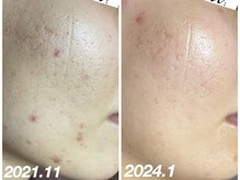 スウ(su:)/根深いお悩みもお任せ下さい