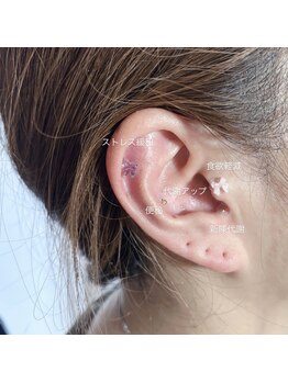 プリュネ(Prune)/耳つぼジュエリー/リフトアップ