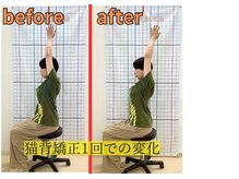 きずな鍼灸整骨院 武蔵ヶ丘本院/猫背矯正